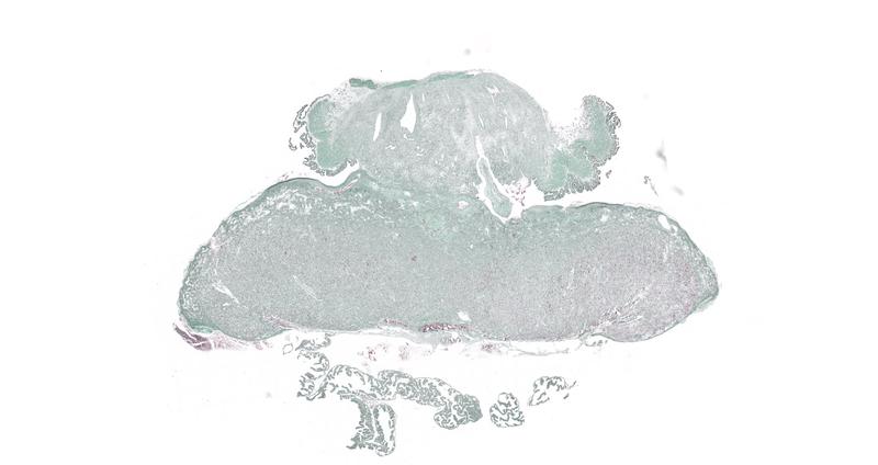  Histologisches Bild einer Rattenplazenta: Forschende analysierten mit Hilfe dieses Bildes u.a. die Spiralarterien um Rückschlüsse auf die Versorgung des Fötus zu gewinnen. 