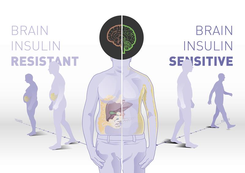 Insulin action in the brain determines body weight, fat distribution and how to respond to lifestyle interventions.