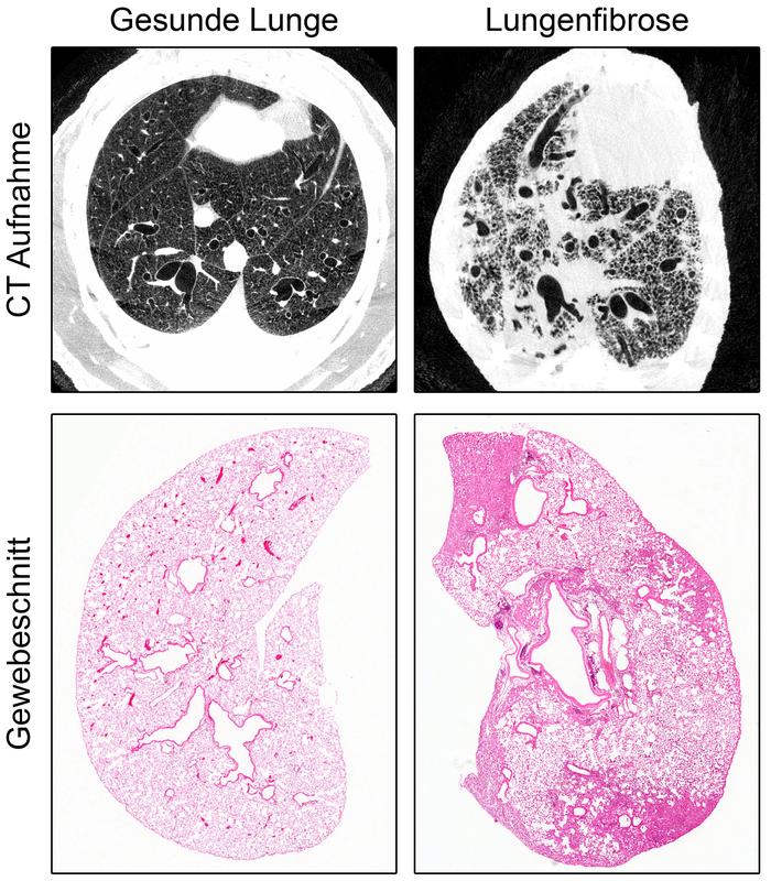 Schwere Lungenfibrose im Tiermodell: In computertomographischen (CT) Aufnahmen und in Gewebeschnitten ist zu erkennen, dass gesundes, luftgefülltes Gewebe durch verdicktes Bindegewebe ersetzt wird.
