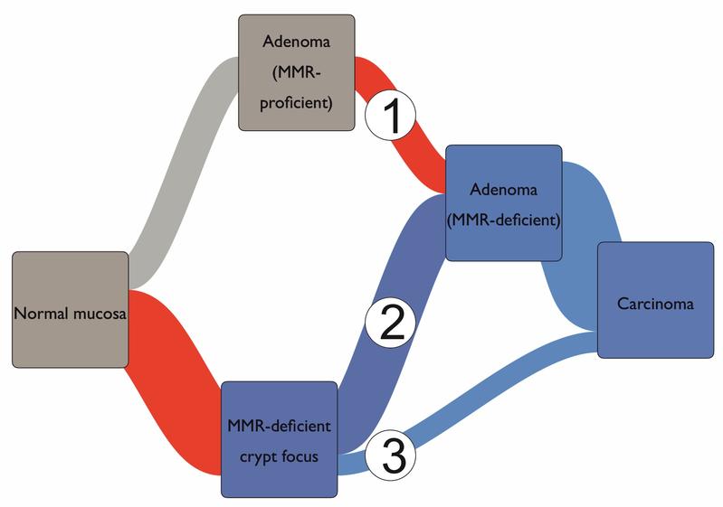 Integratives Modell der Darmkrebs-Entstehung beim Lynch-Syndrom