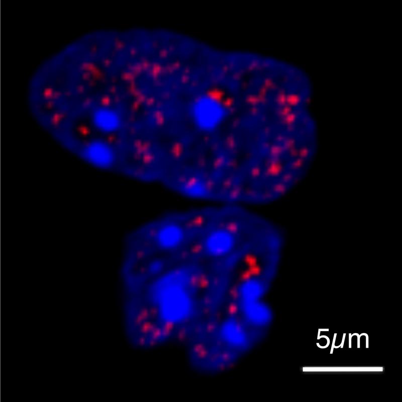 Zellkerne von Zellen in der Kultur unter dem Mikroskop. Kondensate, die das Protein HOXD13 enthalten, erscheinen rot. Die DNA ist blau gefärbt.