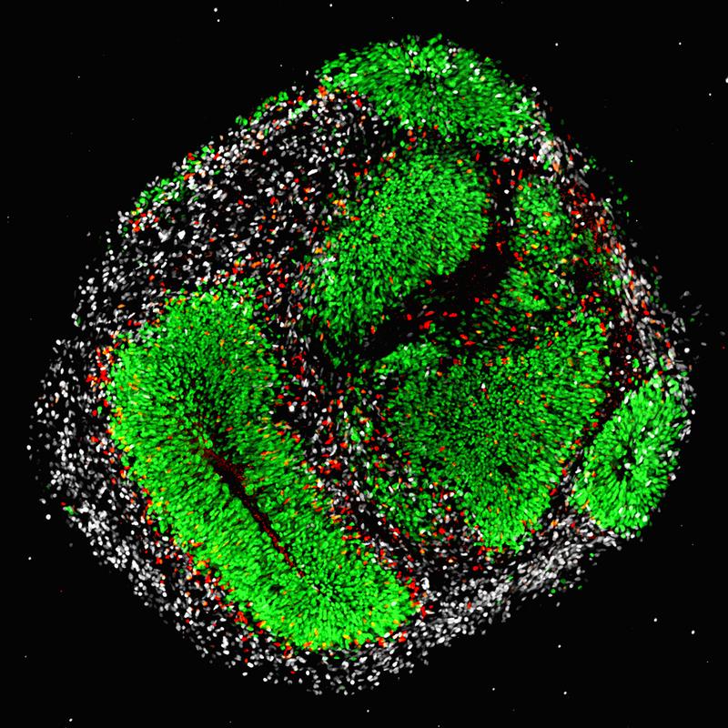 Hirnorganoide, gebildet von humanen embryonalen Stammzellen, sind organähnliche Zellkulturen des menschlichen Gehirns bestehend aus neuralen Stamm- (rün), Vorläufer- (rot) und Nervenzellen (weiss). (