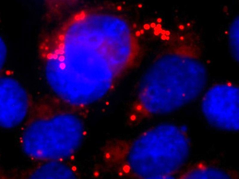 Nach Hemmung der Sekretase  sammeln sich in den Astrozyten (ihr Zellkern ist blau gefärbt), große Mengen von Lipidtröpfchen (rot) an. Diese stören die normale Zellfunktion. 