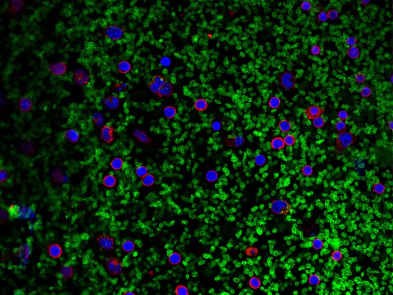 Mikroskopaufnahme: Blutplättchen (grün) tragen zur Aktivierung von Inflammasomen in weißen Blutzellen (rot; Zellkerne: blau) bei und somit zu einer vermehrten IL-1-Produktion. 