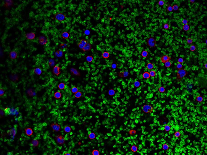 Microscope image: Platelets (green) contribute to the activation of inflammasomes in white blood cells (red; nuclei: blue) and thus to an increased IL-1 production. 