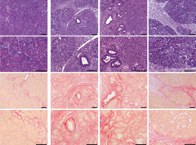 Using a mouse model, the scientists were able to show that a calcium channel is involved in the development of pancreatitis.