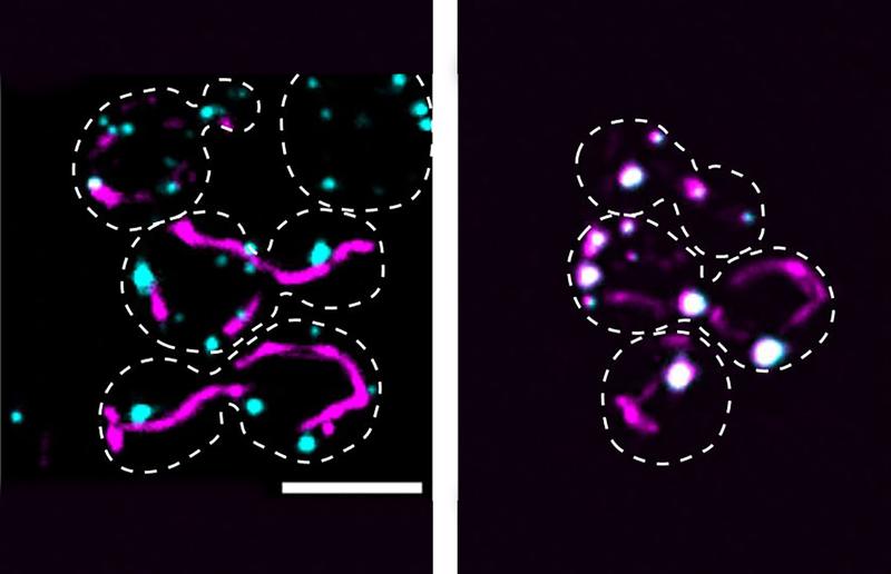 Ein Protein, zwei Einsatzorte (vollständige Biildunterschrift: <https://www.uni-marburg.de/de/aktuelles/news/2020/tauziehen-in-der-zelle-verhindert-vergiftung>)