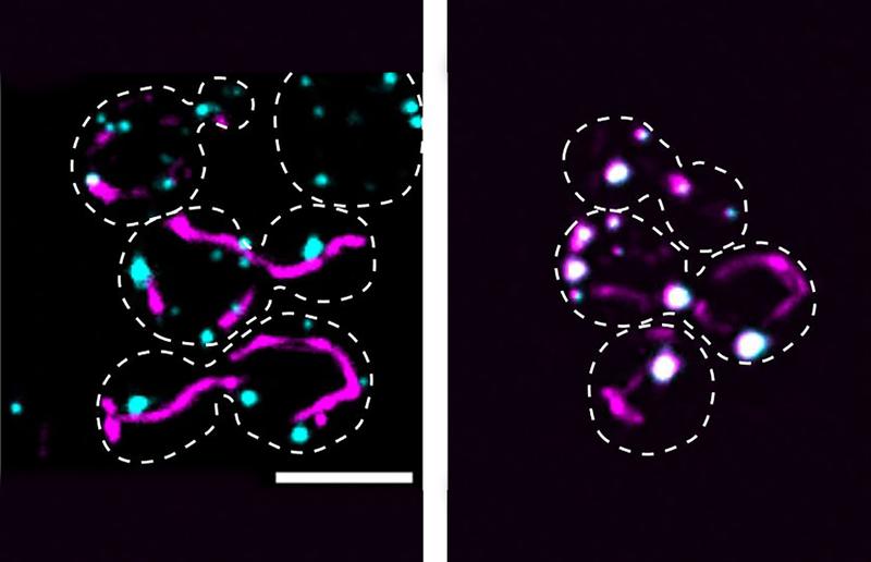 Ein Protein, zwei Einsatzorte (vollständige Biildunterschrift: <https://www.uni-marburg.de/de/aktuelles/news/2020/tauziehen-in-der-zelle-verhindert-vergiftung>)