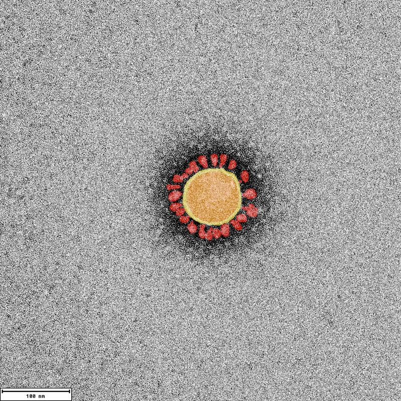 Das Bild zeigt ein negativ kontrastiertes SARS-CoV-2-Partikel, aufgenommen mit einem Transmissions-Elektronenmikroskop und koloriert an der Universität Marburg. 