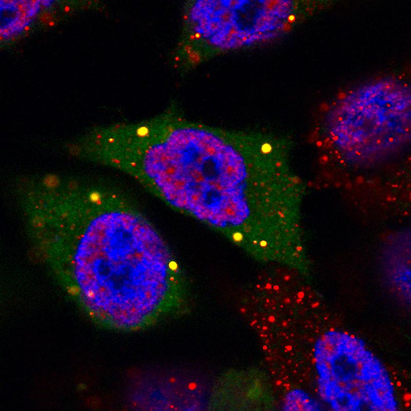 Das regulatorische Protein 4E-T (grün) unter dem Mikroskop mit Fluoreszenzfarbstoffen sichtbar gemacht.
