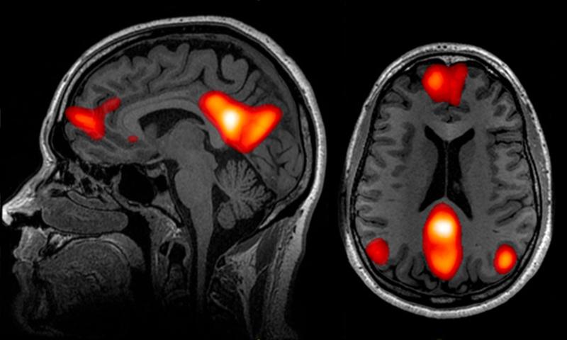 70 Forschungsteams haben die Daten von Gehirnscans während eines ökonomischen Experiments mit verschiedenen Methoden analysiert und verglichen. Sie kamen nicht immer zum gleichen Ergebnis.