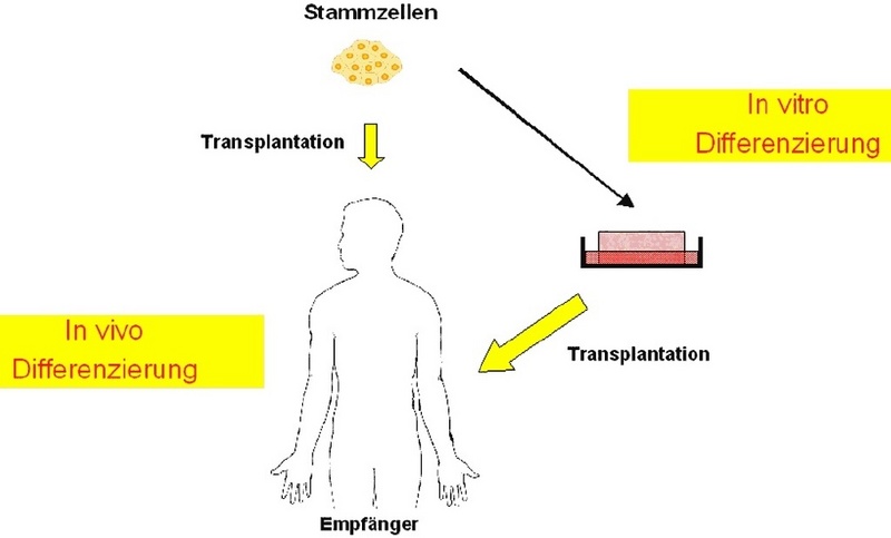 Die Stammzellen aus der Bauchspeicheldrüse könnten sich entweder direkt im Organismus (in vivo) oder schon vorher im Reagenzglas (in vitro) zu Insulin bildenden Zellen weiterentwickeln. Grafiken (2): Seufert