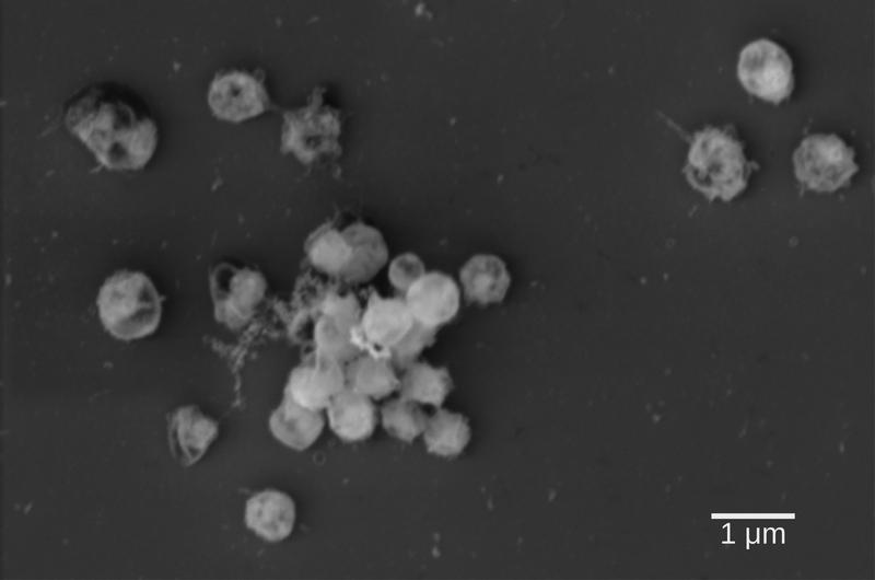 Elektronen-mikroskopische Aufnahme von Lentimonas, einem neu isolierten Bakterium das Fucoidan abbauen kann an. Man sieht, dass die Zellen kleine runde Kokken sind und als Aggregat wachsen
