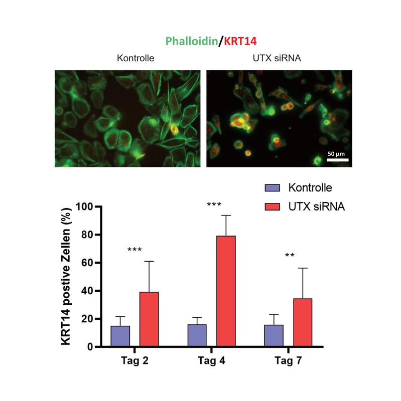 Die Inaktivierung des Regulatorproteins UTX in normalen Urothelzellen kann über die Anreicherung von Stammzellen, nachgewiesen über den Marker KRT 14, die Entstehung von Harnblasentumoren fördern.