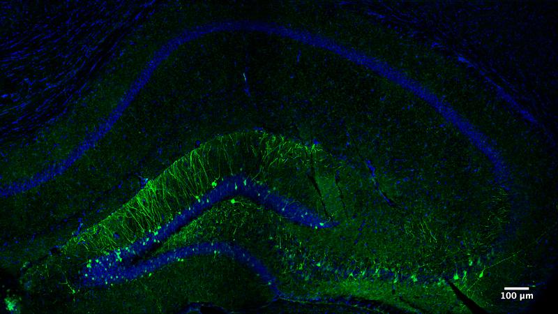 The illustration shows the part of a mouse’s hippocampus that is activated while learning a new task. The neurons that encode the specific memory of this task are shown in green.