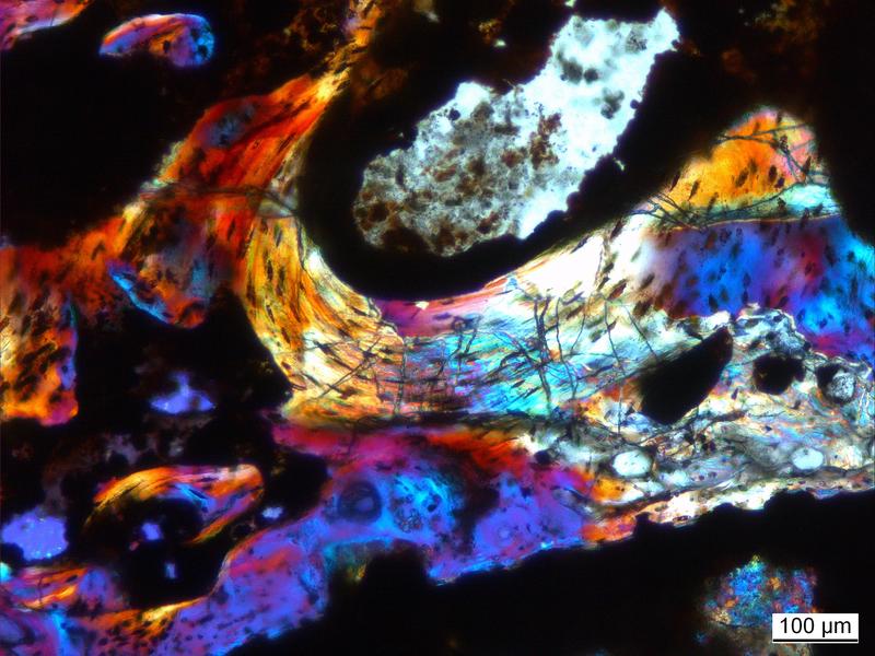 Knochenbälkchen von Dimetrodon unter dem Mikroskop im polarisierten Licht. Die bunten Farben zeigen die Richtung der Knochenkristallite an, die wiederum von der Wachstumsgeschwindigkeit des Knochens abhängt. 