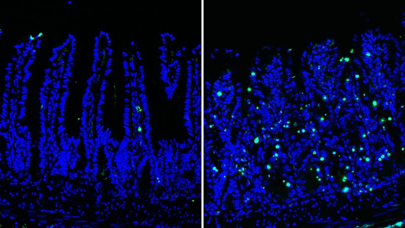 Healthy (right) vs diseased (left) bowel: Extensive DNA damage (green) within the intestinal epithelium leads to inflammatory cell death and disrupts intestinal homeostasis