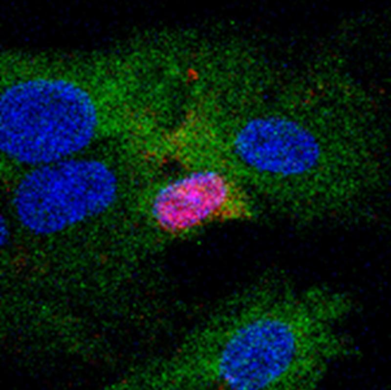 Studies of the innate immune response following an HBV infection; blue: Cell nuclei from hepatocytes, red: core protein of the hepatis B virus (HBc antigen), green: Marker for immune activation (IRF-3).