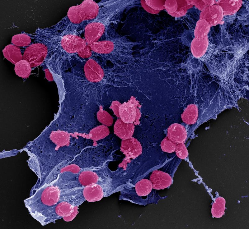 Scanning electron microscope image of Stieleria maiorica. Cells in pink. Matrix in blue. 