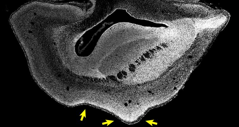 Mikroskopische Aufnahme eines Hirnhälften-Schnitts eines 101 Tage alten ARHGAP11B-transgenen Weißbüschelaffen-Fötus. Die Zellkerne sind weiß dargestellt. Pfeile zeigen einen Sulcus und einen Gyrus an. 