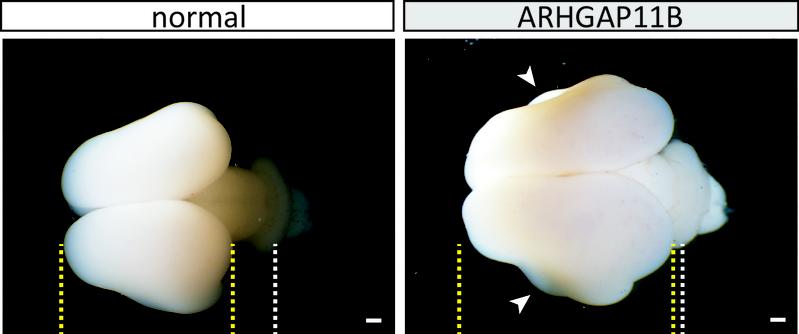 Wildtype (normal) and ARHGAP11B-transgenic fetal (101 days) marmoset brains. Yellow lines, boundaries of cerebral cortex; white lines, developing cerebellum; arrowheads, folds. Scale bars, 1 mm.