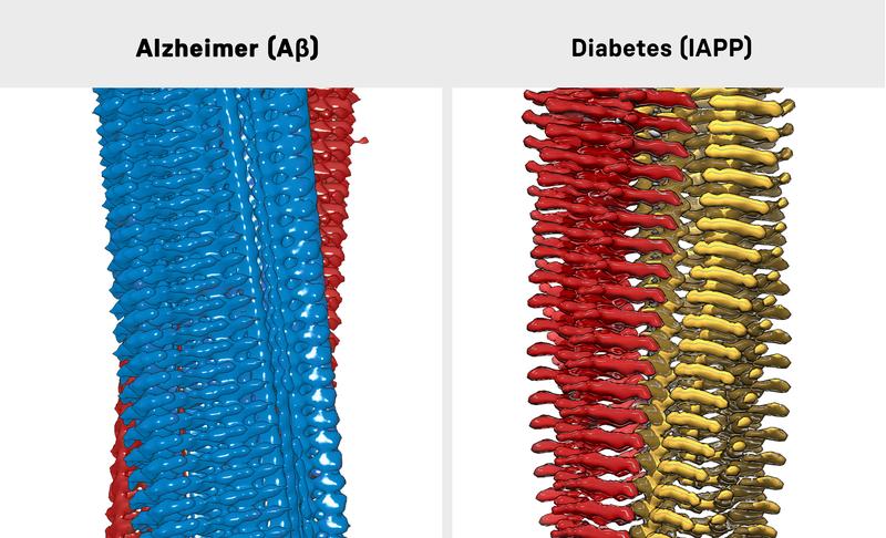 3D-Rekonstruktion einer Amyloid-beta-Fibrille (links) und einer IAPP-Fibrille (rechts)