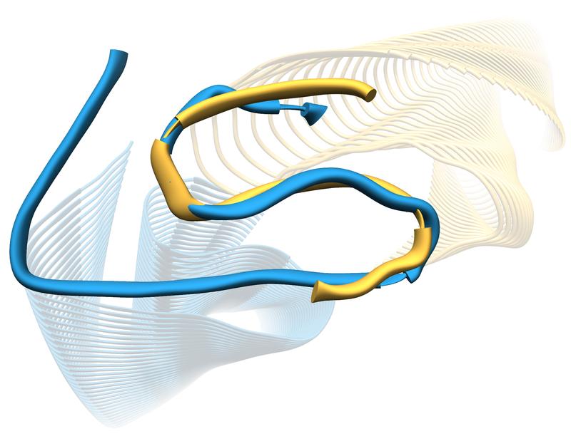 Querschnitte der 3D-Modelle der sogenannten Protofilamente von IAPP- und Aβ-Amyloidfibrillen. Die Überlagerung einzelner IAPP- und Aβ-Moleküle zeigt die Ähnlichkeit der S-förmigen Faltungen.  