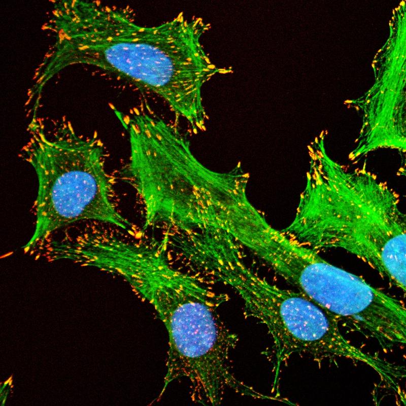 Bei der in vitro-Dosimetrie wird ein komplexes Bild der Nanopartikel-Wirkungen in Zellkulturen ermittelt.