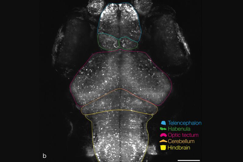 Ein Zebrafischgehirn einer 6 Tage alten Larve im NeuroExaminer zeigt spontane Aktivität. Jeder der hellen weißen Punkte visualisiert eine aktive Nervenzelle. Nicht-aktive Nervenzellen sind weniger hell.