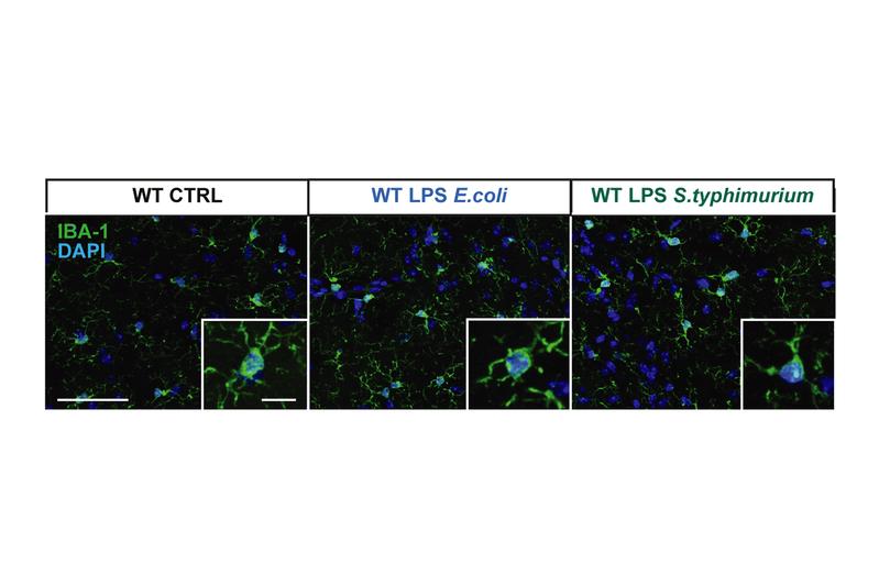 The number of microglial cells changes during stimulation of the immune system (pictures in the middle and on the right): In this case more glial cells (green) are present and activated than in the control group (left).