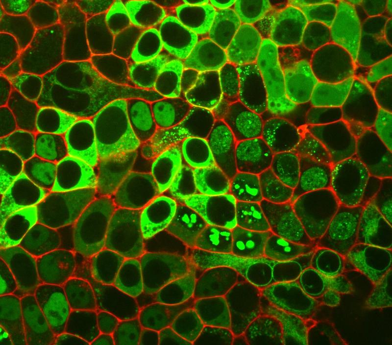 Leuchtende Proteine in menschlichen Zellen: In jeder Zelle ist ein menschliches Protein mit einem grün fluoreszierenden Marker versehen. Die Zellmembran ist rot gefärbt. 