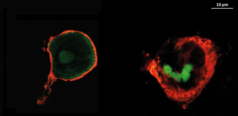 Images of macrophages (red) in which the active substance (green) is distributed. On the left, the active substance heparin is shown, on the right hyaluronic acid.