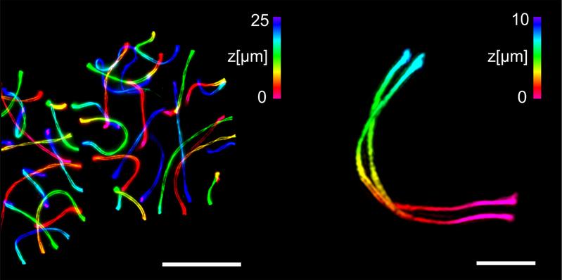 Links zwei spermienbildende Zellen, die mit ExM-SIM expandiert wurden. Rechts die detaillierte 3D-Aufnahme eines einzelnen synaptonemalen Komplexes. Die 3D-Information ist farblich kodiert. 