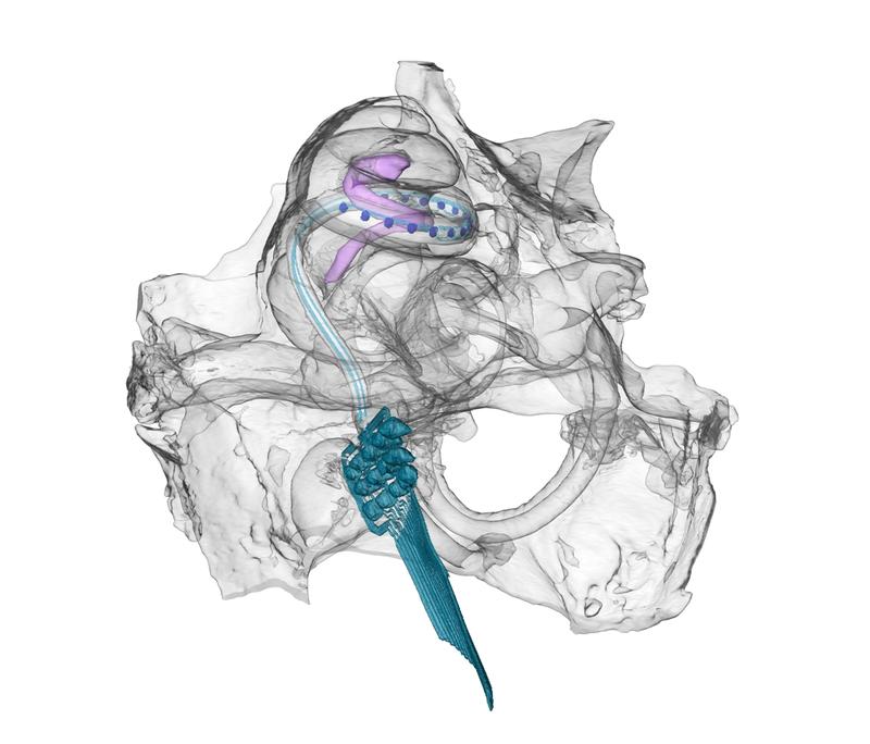 Optical cochlear implant in the cochlea of a gerbil