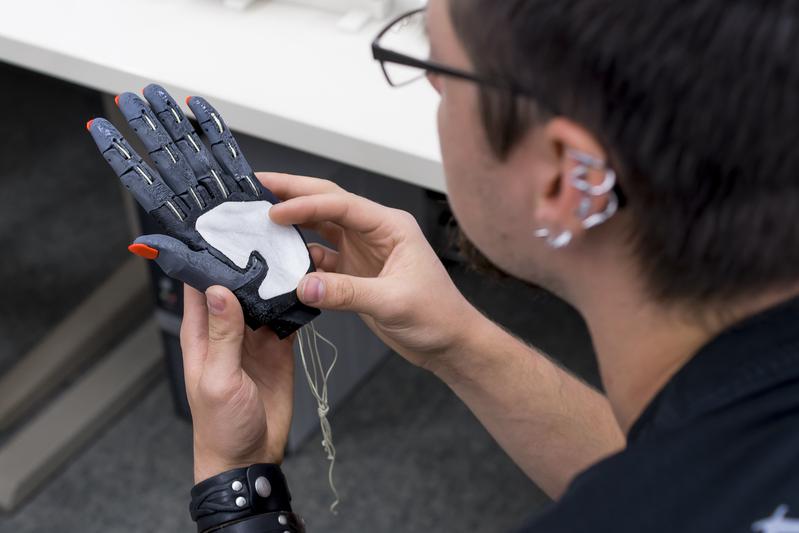Handprothese aus dem 3D-Drucker