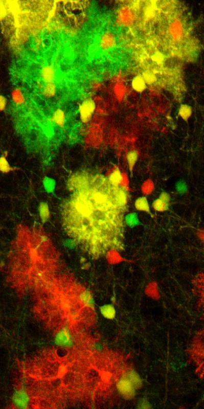 Astrocytes in the mouse brain, labelled using the MADM technique.