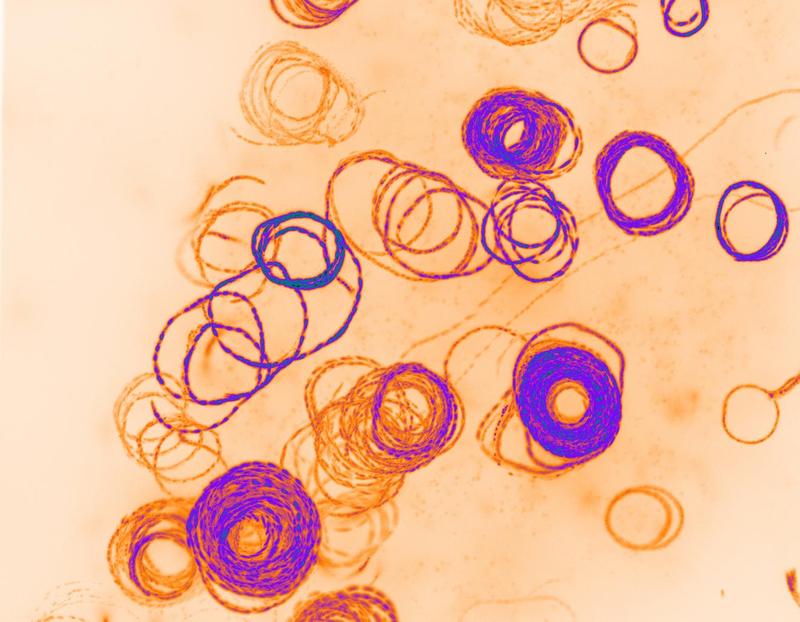 Mit Hilfe des Proteins TRAP können Malariaparasiten nicht nur, wie auf dem Bild zu sehen, ihre Kreise ziehen, sondern auch unterschiedliche Zielzellen infizieren. Für die Aufnahme wurde TRAP mit einem fluoreszierenden Protein markiert.