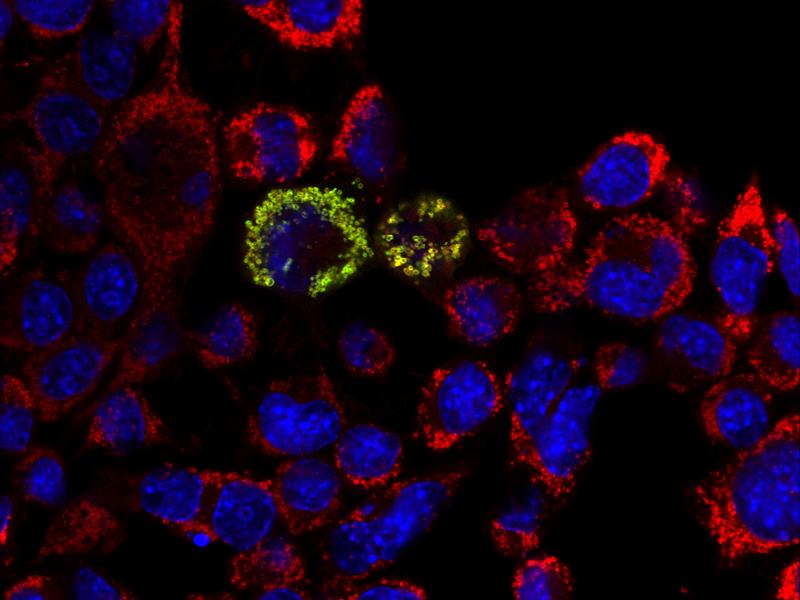 In kultivierter Nervenzellen zeigt sich das grün angefärbte Protein HPDL in den rot angefärbten Mitochondrien durch Überlagerung in Gelb.