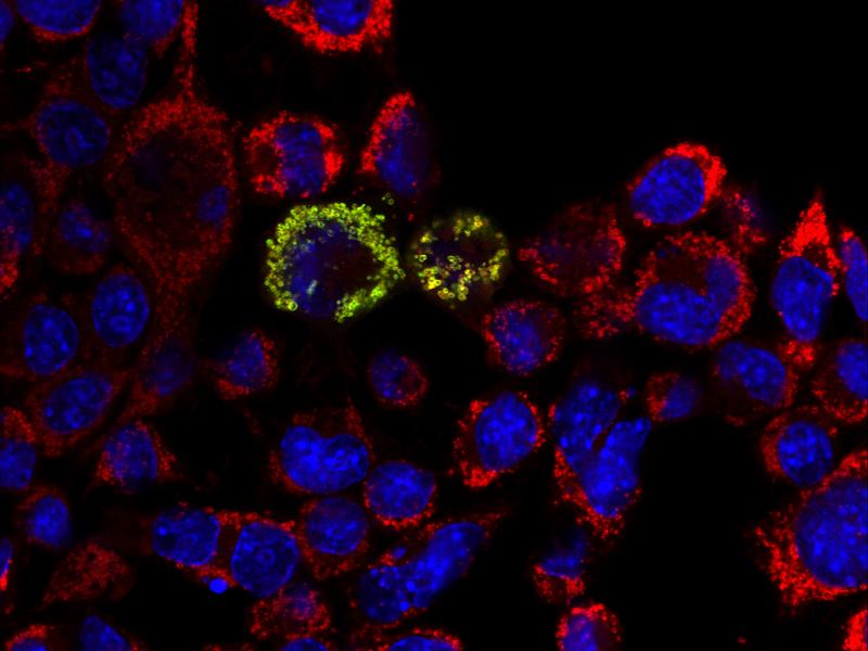 In kultivierter Nervenzellen zeigt sich das grün angefärbte Protein HPDL in den rot angefärbten Mitochondrien durch Überlagerung in Gelb.