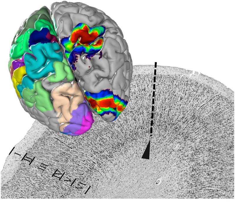 Die Architektur der Nervenzellen ändert sich an der Grenze zwischen zwei Arealen (gestrichelte Linie). Das ist die Grundlage der Kartierung. Die Areale der untersuchten Gehirne werden in den Julich-Brain Atlas gebracht und hier überlagert. 