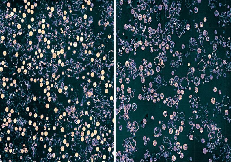 Resting Chlamydia (left; bright circles), which are held without glutamine. After the addition of glutamine (right) the bacteria enter the division stages (darker circles).