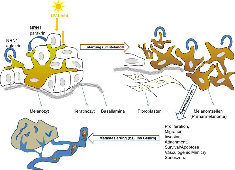 Das Wachstumsprotein Neuritin 1 (NRN1) kann in den Melanozyten der Haut die Entstehung eines Melanoms fördern.
