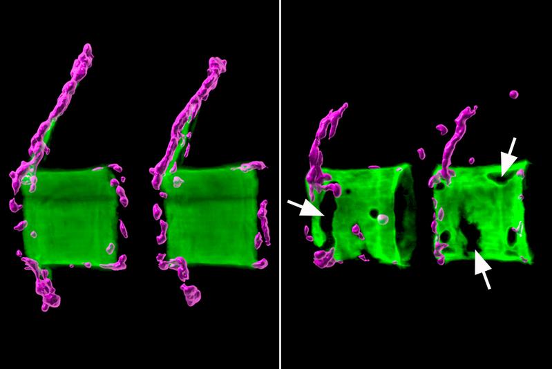 Links zwei gesunde Wirbelkörper aus der Wirbelsäule eines Medaka-Fisches: Die Knochenmatrix (grün) ist normal mineralisiert und von knochenbildenden Zellen (magenta) umgeben. Rechts die Situation bei einem osteoporotischen Fisch.