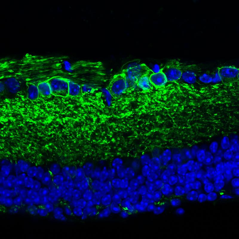 In dieser Netzhaut leuchten die Zellen grün, die mit per Gentherapie dazu gebracht wurden, ein lichtsensitives Protein zu produzieren.
