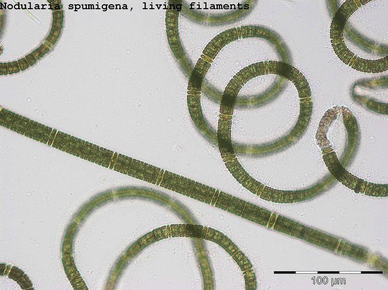 Nodularia spumigena ist die häufigste Cyanobakterien-Art in der zentralen Ostsee