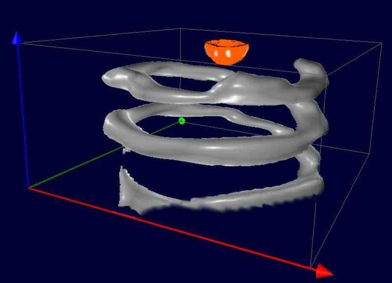 Simuliertes Blutgefäß (grau) und Fremdkörper (orange):  Ein spiralig gewundener Kunststoff-Schlauch (ø 1mm) wurde mit Nanopartikeln einer Größe befüllt und zusammen mit einem Testkörper aus anderen Nanopartikeln vermessen.