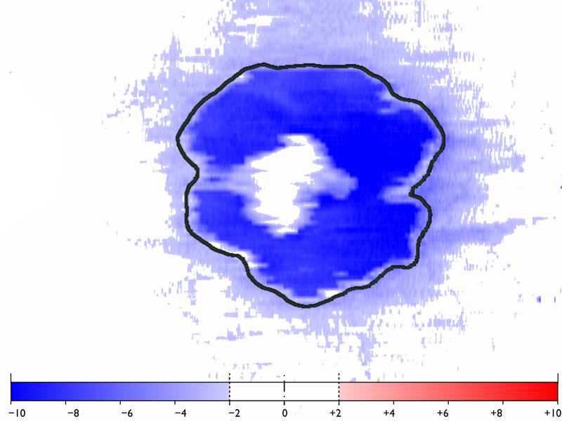 Thickness of the outer nuclear layer (ONL) derived from OCT data: The photoreceptors are significantly diluted even outside the area of geographic atrophy. 