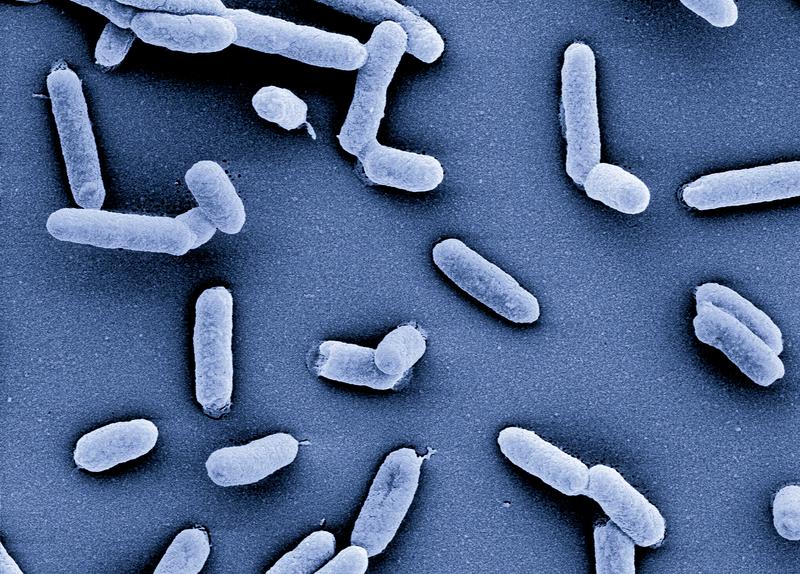 Salmonellen dienten in der Studie zur RNA-Einzellsequenzierung als Modellorganismus