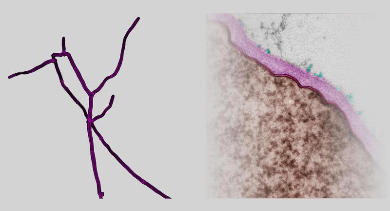 Dfg5-Enzyme von Chaetomium thermophilum (links) bewirken die Übertragung von Zellwandproteinen (rechts, grün) aus der Plasmamembran (rot) auf Zuckerstränge der Oberfläche (vollständige BU: <www.uni-marburg.de>). 