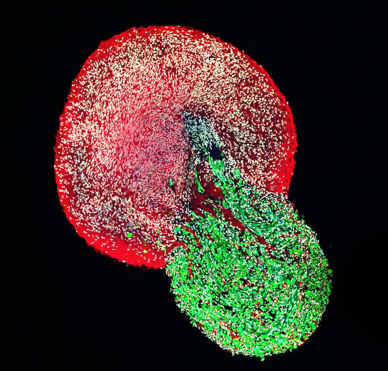 Ein Schnitt durch ein ganzes neuromuskuläres Organoid